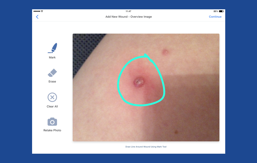 Inteliwound screenshot 3